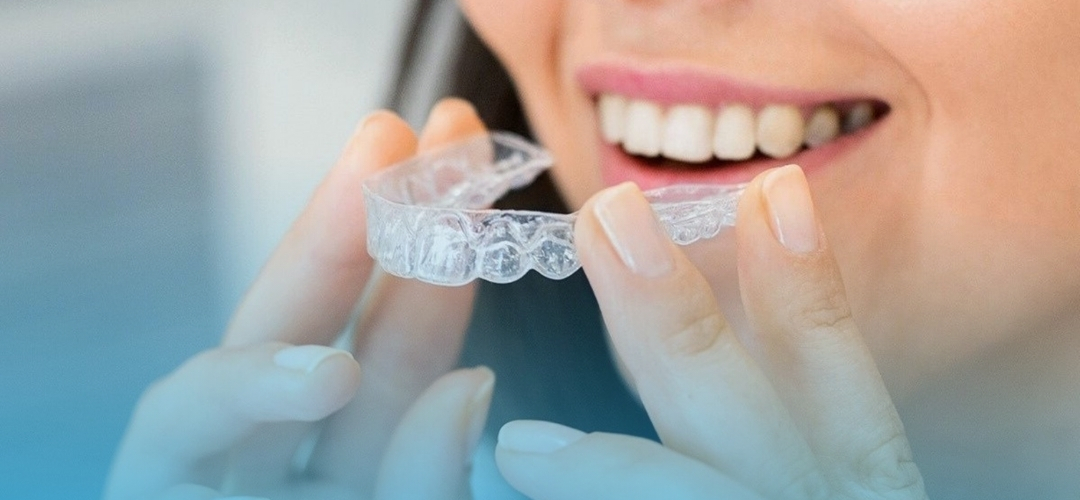 Şeffaf Plak Tedavisi Nedir? Telsiz Ortodonti ile Düzgün Gülüş