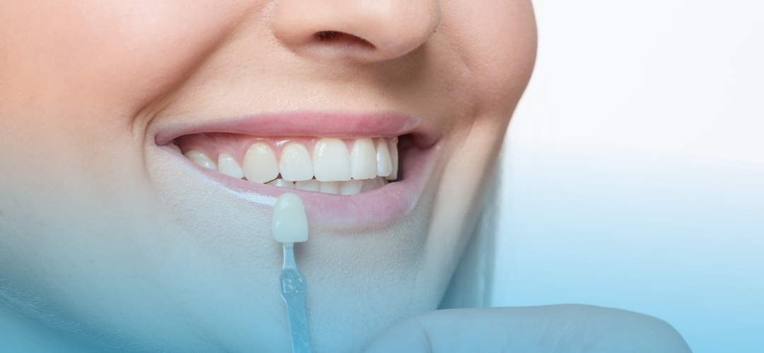 Zirkonyum Kaplama Nedir? Estetik ve Dayanıklı Diş Çözümleri